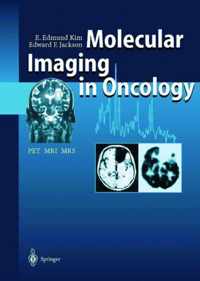 Molecular Imaging in Oncology