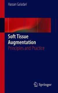 Soft Tissue Augmentation