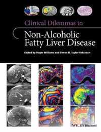 Clinical Dilemmas in Non-Alcoholic Fatty Liver Disease