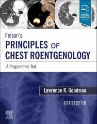 Felson's Principles of Chest Roentgenology, A Programmed Text