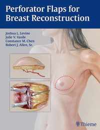 Perforator Flaps for Breast Reconstruction