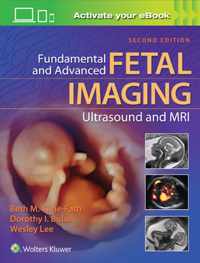 FUND ADVANCED FETAL IMAGING MRI 2E CB