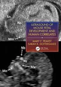 Ultrasound of Mouse Fetal Development and Human Correlates