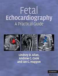 Fetal Echocardiography