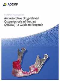 Antiresorptive Drug-Related Osteonecrosis of the Jaw (ARONJ) - A Guide to Research