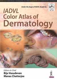 IADVL Color Atlas of Dermatology