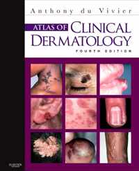 Atlas of Clinical Dermatology