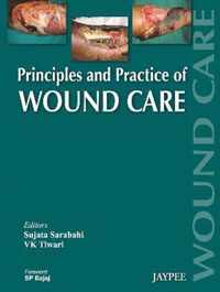 Principles and Practice Of Wound Care