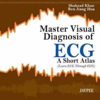 Master Visual Diagnosis of ECG