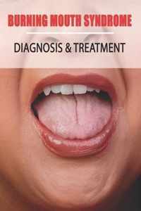 Burning Mouth Syndrome: Diagnosis & Treatment