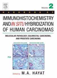 Handbook of Immunohistochemistry and in Situ Hybridization of Human Carcinomas