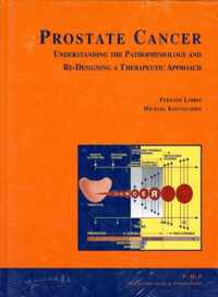 Prostate Cancer