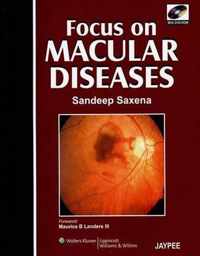 Focus on Macular Diseases