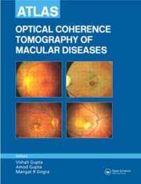 Atlas of Optical Coherence Tomography of Macular Diseases