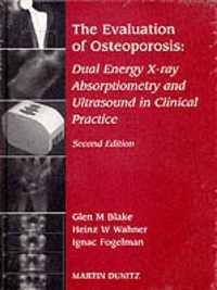 Evaluation Of Osteoporosis