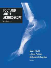 Foot and Ankle Arthroscopy