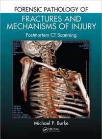 Forensic Pathology of Fractures and Mechanisms of Injury