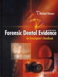 Forensic Dental Evidence