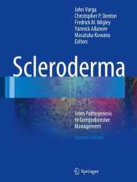 Scleroderma