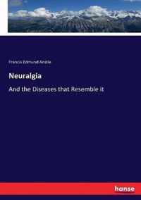 Neuralgia