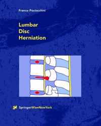 Lumbar Disc Herniation