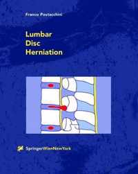 Lumbar Disc Herniation