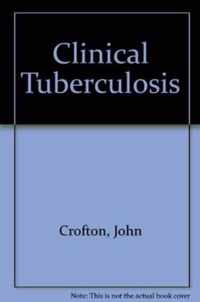 Clinical Tuberculosis