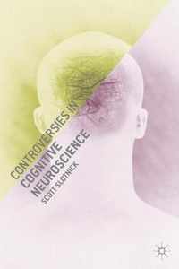 Controversies in Cognitive Neuroscience