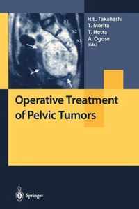 Operative Treatment of Pelvic Tumors