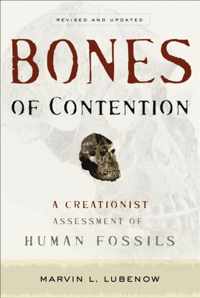 Bones Of Contention