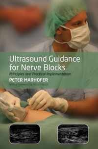 Ultrasound Guidance for Nerve Blocks: Principles a