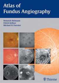 Atlas of Fundus Angiography