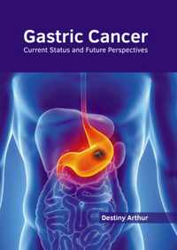 Gastric Cancer