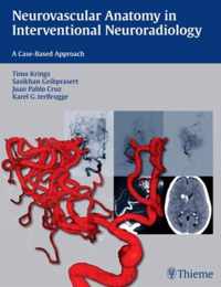 Neurovascular Anatomy In Interventional Neuroradiology