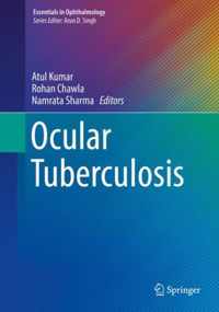 Ocular Tuberculosis