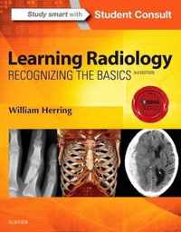 Learning Radiology