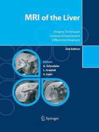 MRI of the Liver