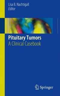 Pituitary Tumors