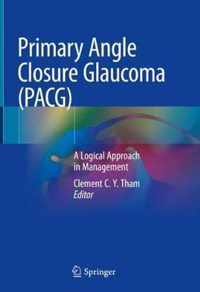 Primary Angle Closure Glaucoma PACG