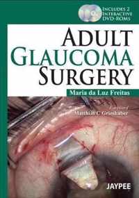 Adult Glaucoma Surgery