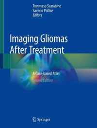 Imaging Gliomas After Treatment