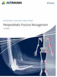 Periprosthetic Fracture Management