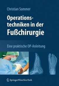 Operationstechniken in der Fusschirurgie