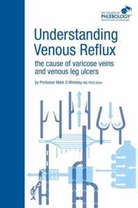 Understanding Venous Reflux the Cause of Varicose Veins and Venous Leg Ulcers