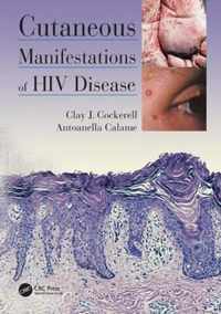 Cutaneous Manifestations of HIV Disease