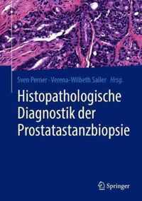 Histopathologische Diagnostik der Prostatastanzbiopsie