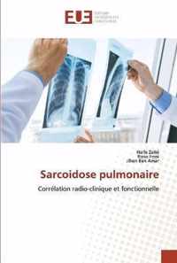 Sarcoidose pulmonaire