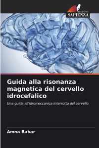 Guida alla risonanza magnetica del cervello idrocefalico