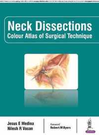 Neck Dissections