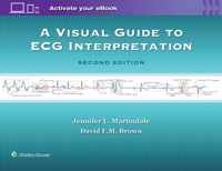 A Visual Guide to ECG Interpretation